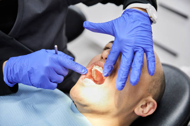 Best Dental Abscess Treatment in Hill City, KS